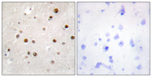 Translin Rabbit Polyclonal Antibody