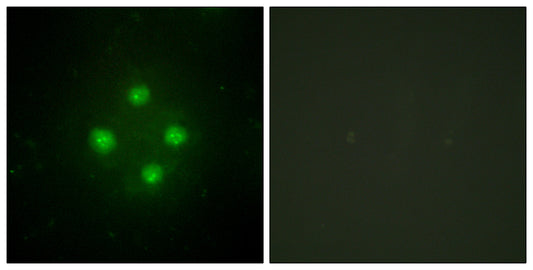 TRAP100 Rabbit Polyclonal Antibody