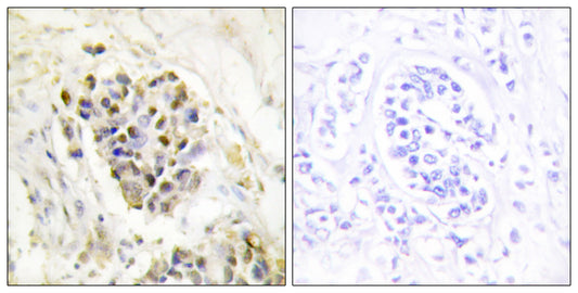 TRAP220 Rabbit Polyclonal Antibody