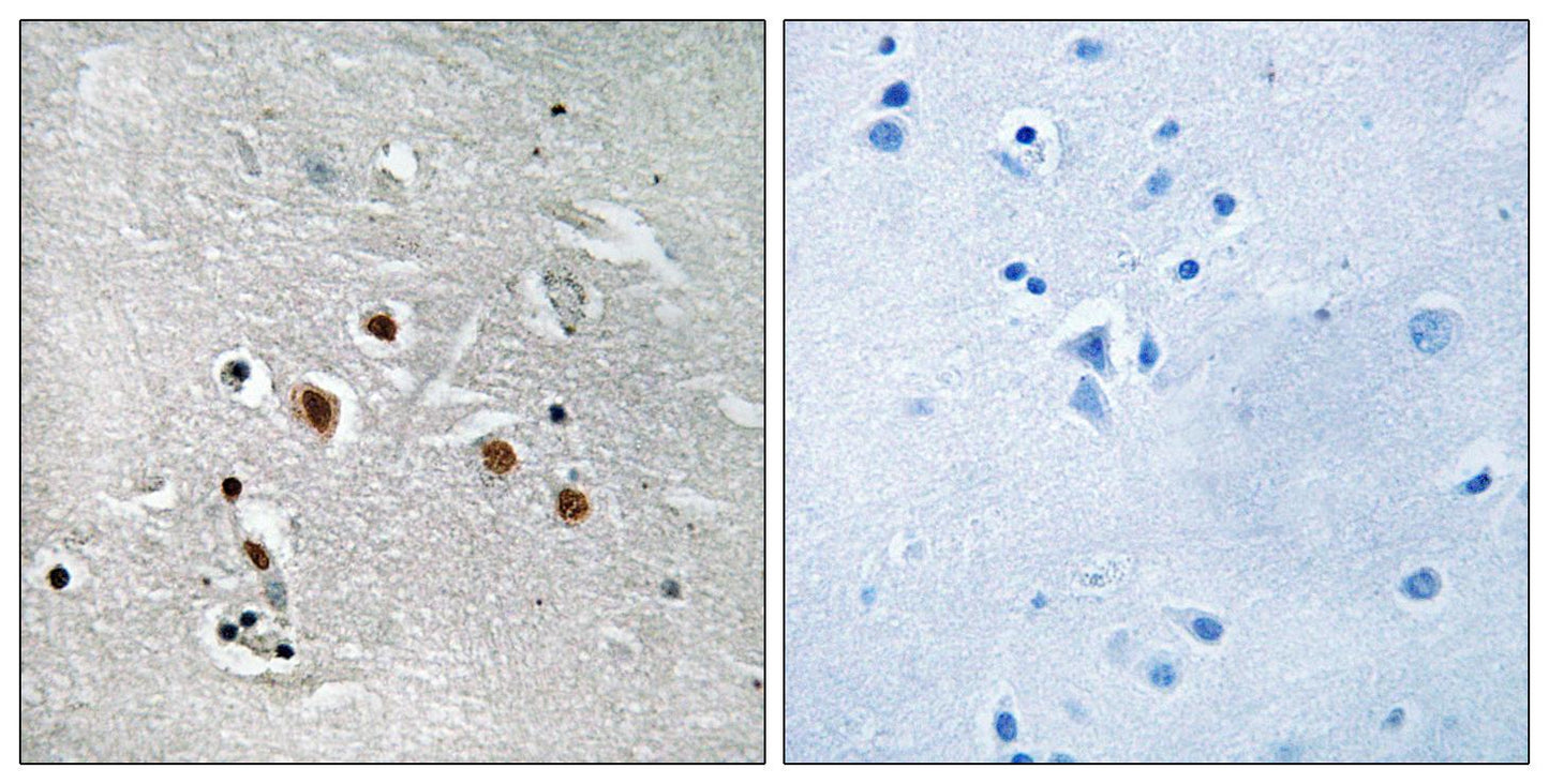 TRAP240 Rabbit Polyclonal Antibody