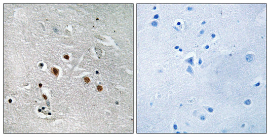 TRAP240 Rabbit Polyclonal Antibody