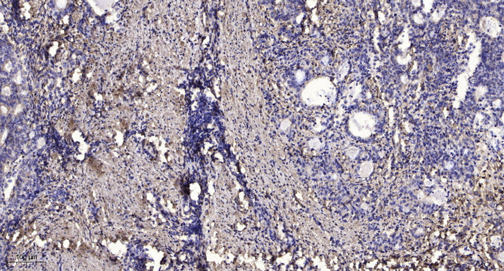 TRAPPC5 Rabbit Polyclonal Antibody