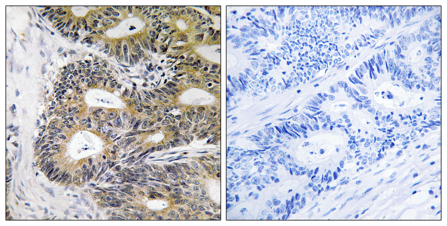 TRAPPC6A Rabbit Polyclonal Antibody