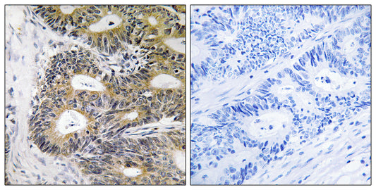 TRAPPC6A Rabbit Polyclonal Antibody