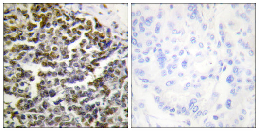 Treacle Rabbit Polyclonal Antibody
