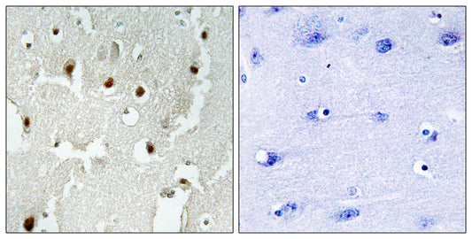 TReP-132 Rabbit Polyclonal Antibody