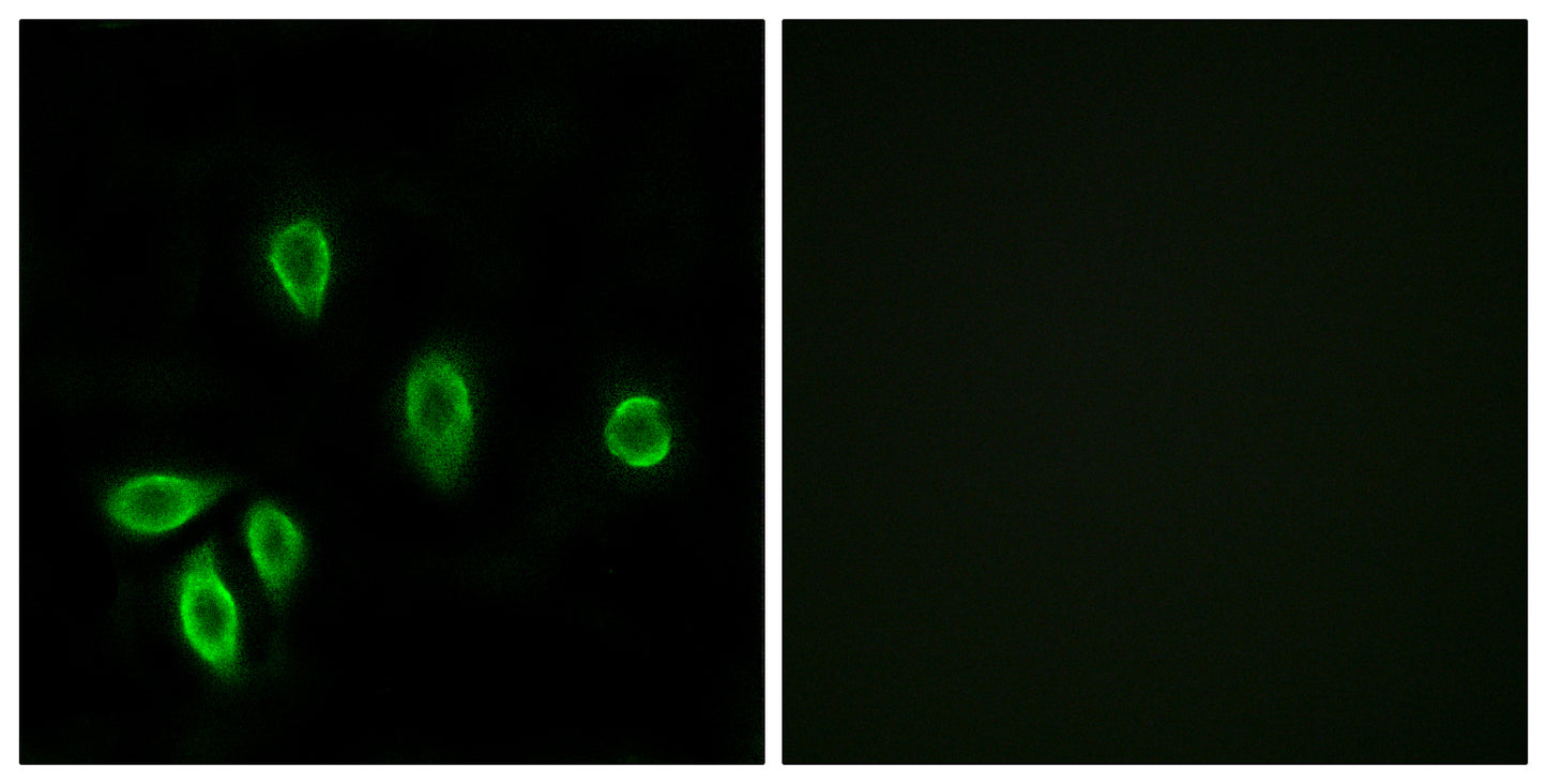 TRH-R1 Rabbit Polyclonal Antibody