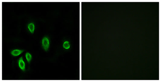 TRH-R1 Rabbit Polyclonal Antibody