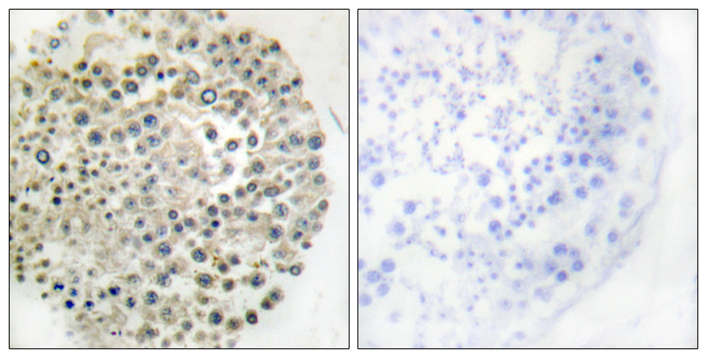 TRIM16 Rabbit Polyclonal Antibody