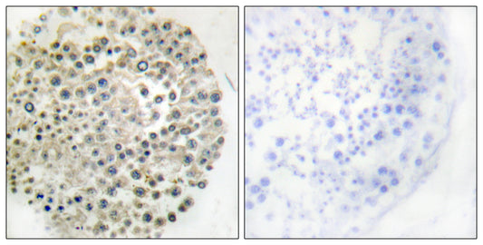 TRIM16 Rabbit Polyclonal Antibody