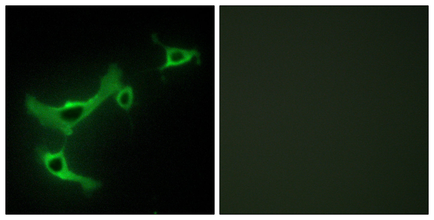 TRIM3 Rabbit Polyclonal Antibody