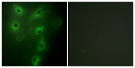 TRIM59 Rabbit Polyclonal Antibody