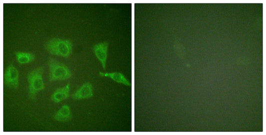 Trk A Rabbit Polyclonal Antibody