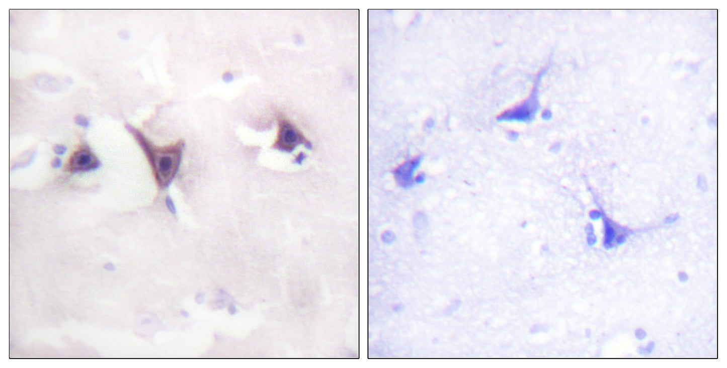 Trk B Rabbit Polyclonal Antibody