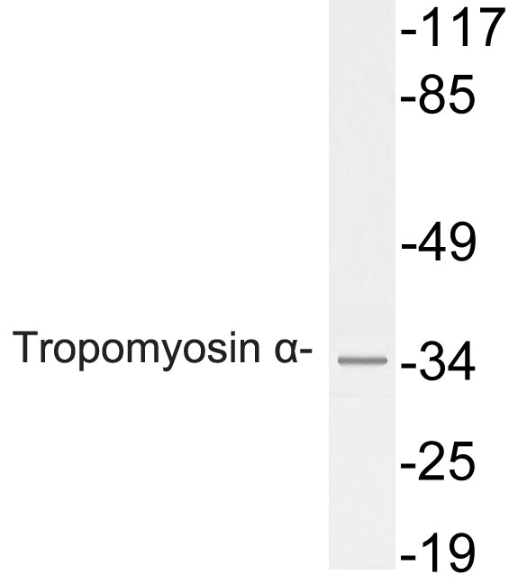 Tropomyosin α Rabbit Polyclonal Antibody