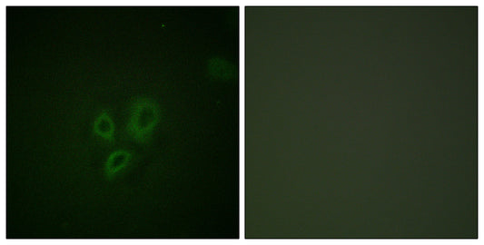Troponin I-C Rabbit Polyclonal Antibody