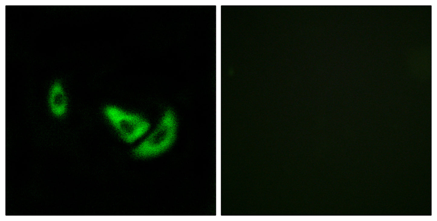TRP2 Rabbit Polyclonal Antibody