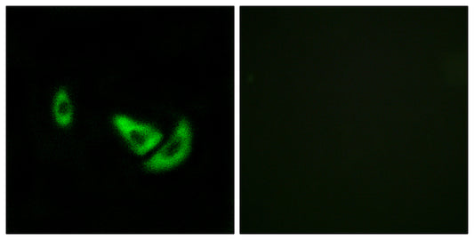 TRP2 Rabbit Polyclonal Antibody