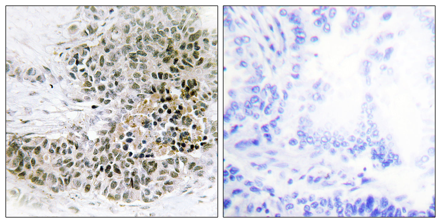 TRPS1 Rabbit Polyclonal Antibody