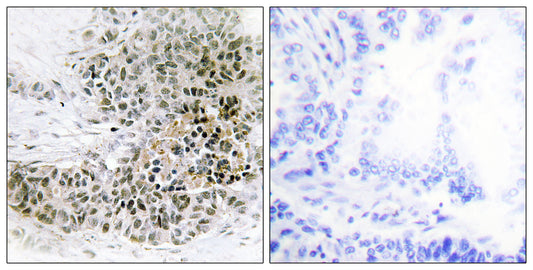 TRPS1 Rabbit Polyclonal Antibody