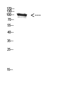 TRPV4 Rabbit Polyclonal Antibody