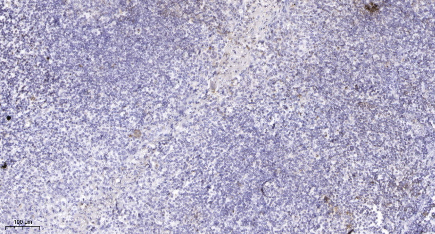 TRRAP Rabbit Polyclonal Antibody