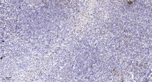 TRRAP Rabbit Polyclonal Antibody