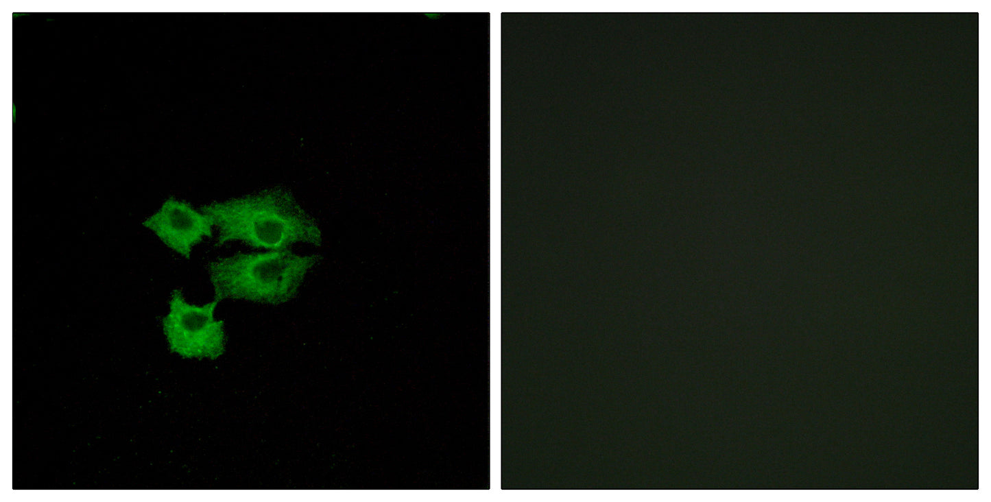 TSA-1 Rabbit Polyclonal Antibody