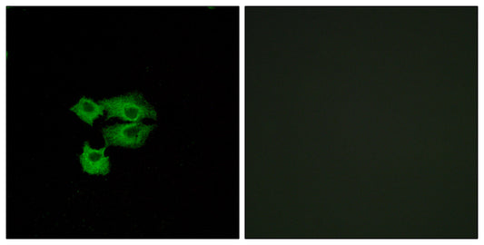TSA-1 Rabbit Polyclonal Antibody