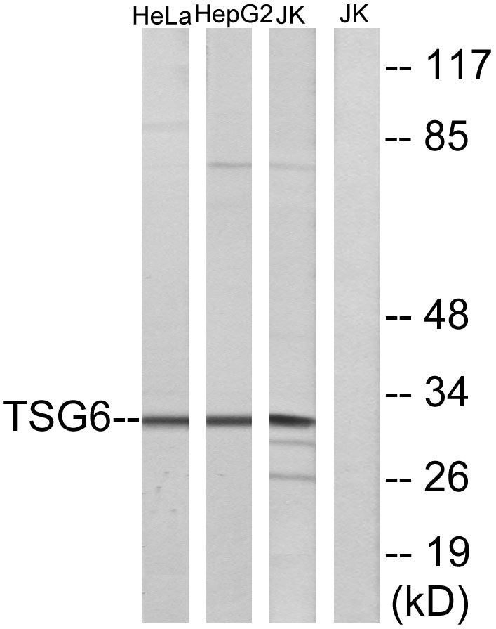 TSG-6 Rabbit Polyclonal Antibody