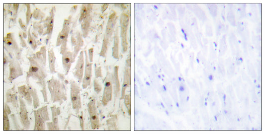 TSHZ1 Rabbit Polyclonal Antibody