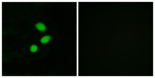 TSHZ2 Rabbit Polyclonal Antibody