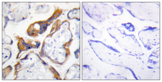 TSSC3 Rabbit Polyclonal Antibody