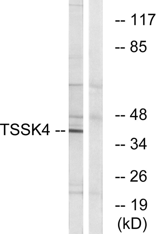 TSSK 4 Rabbit Polyclonal Antibody