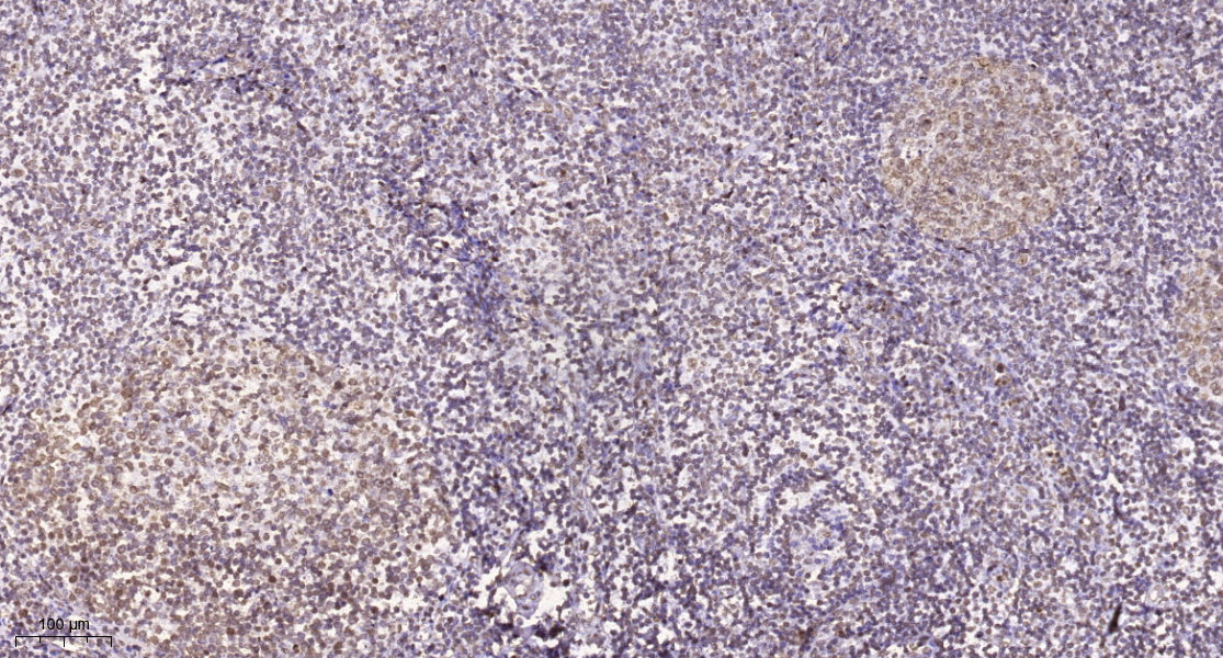 TSSK 6 Rabbit Polyclonal Antibody
