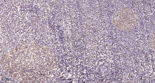 TSSK 6 Rabbit Polyclonal Antibody