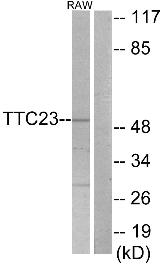 TTC23 Rabbit Polyclonal Antibody
