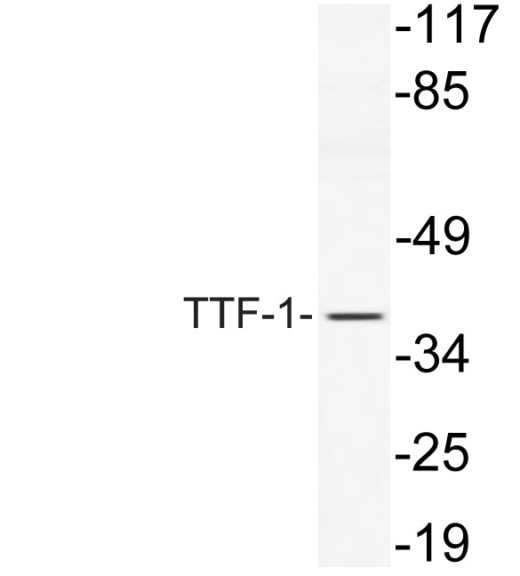 TTF-1 Rabbit Polyclonal Antibody