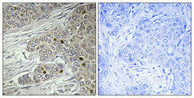 TTF-I Rabbit Polyclonal Antibody