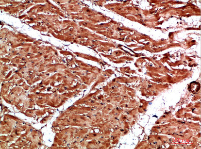 TTN Rabbit Polyclonal Antibody