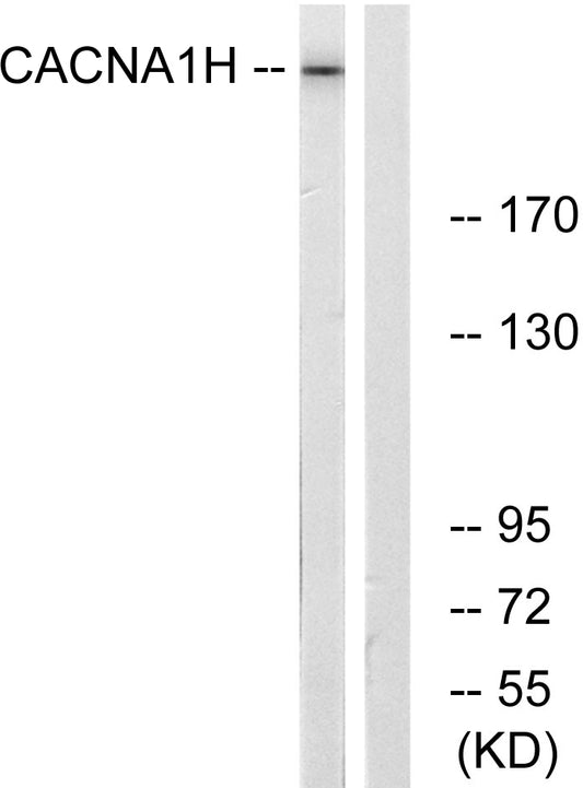 T-type Ca++ CP α1H Rabbit Polyclonal Antibody