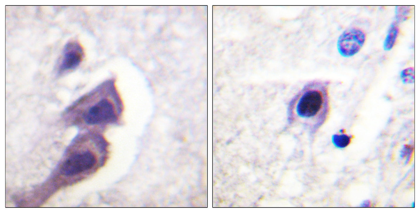 Tuberin Rabbit Polyclonal Antibody