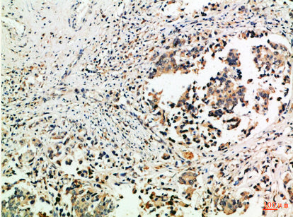 Tubulin γ Rabbit Polyclonal Antibody