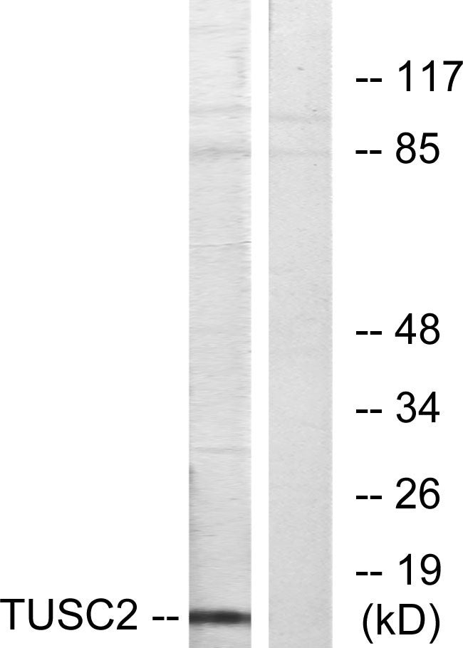 TUSC2 Rabbit Polyclonal Antibody