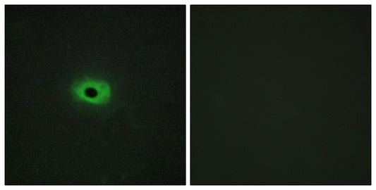 TWEAK Rabbit Polyclonal Antibody