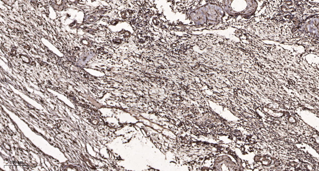 Txk Rabbit Polyclonal Antibody