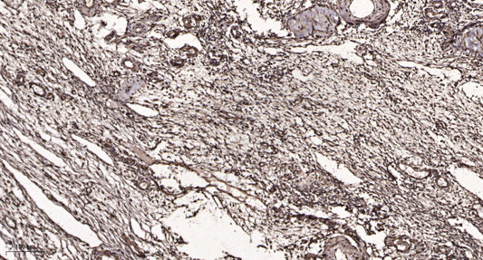 Txk Rabbit Polyclonal Antibody