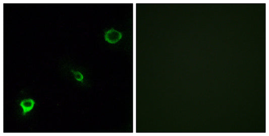 Tyk 2 Rabbit Polyclonal Antibody