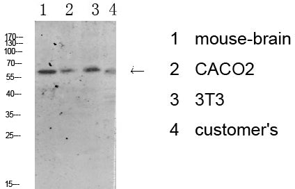 Tyrosine Hydroxylase Rabbit Polyclonal Antibody