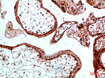Ub Rabbit Polyclonal Antibody